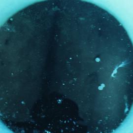 Plankton Down Hole in Sea Ice