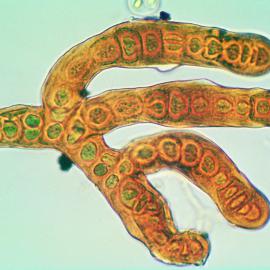 Blue-Green Algae: Stigonema 