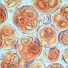 Blue-Green Algae: Uni cells embedded in mucilaginous colonies
