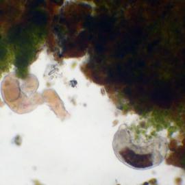 Algae, tardigrades, rotifers