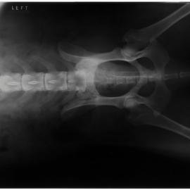 Xrays_Loose_001